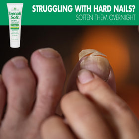 Miracle of Aloe being applied to toenail at night for overnight softening