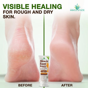 Miracle of Aloe close-up spread highlighting smooth, non-greasy finish