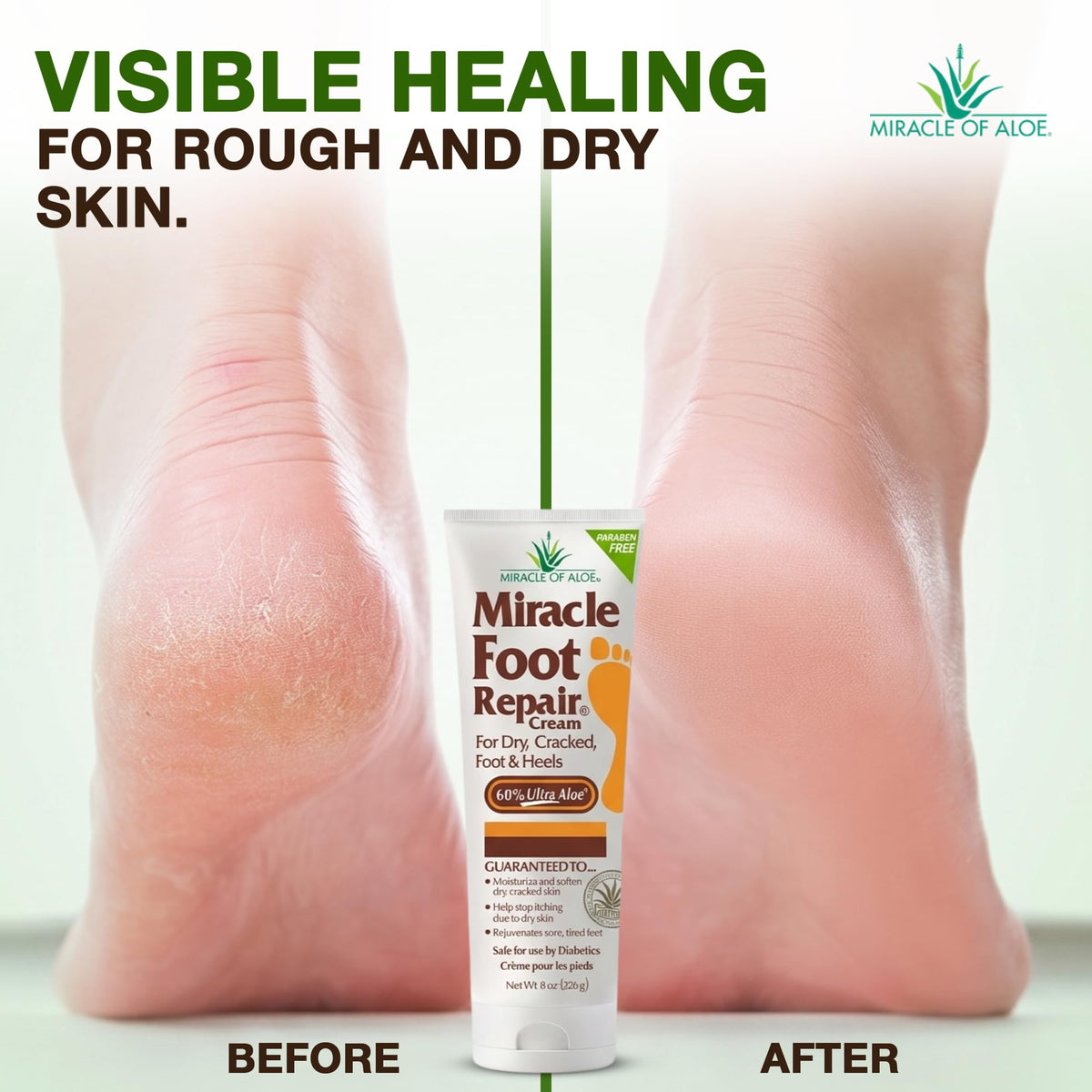 Miracle of Aloe 8 oz tub next to coin for clear size reference
