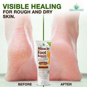 Miracle of Aloe 8 oz tub next to coin for clear size reference