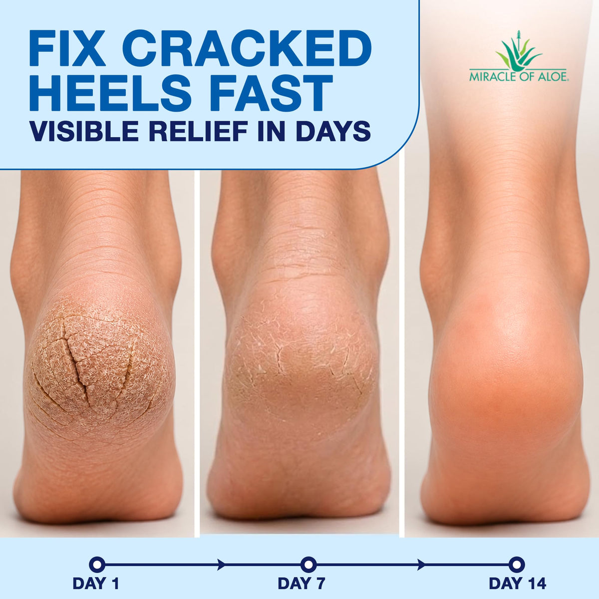 Miracle of Aloe open applicator detail illustrating mess-free glide and precise use