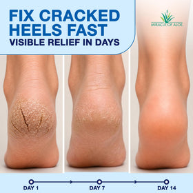 Miracle of Aloe open applicator detail illustrating mess-free glide and precise use