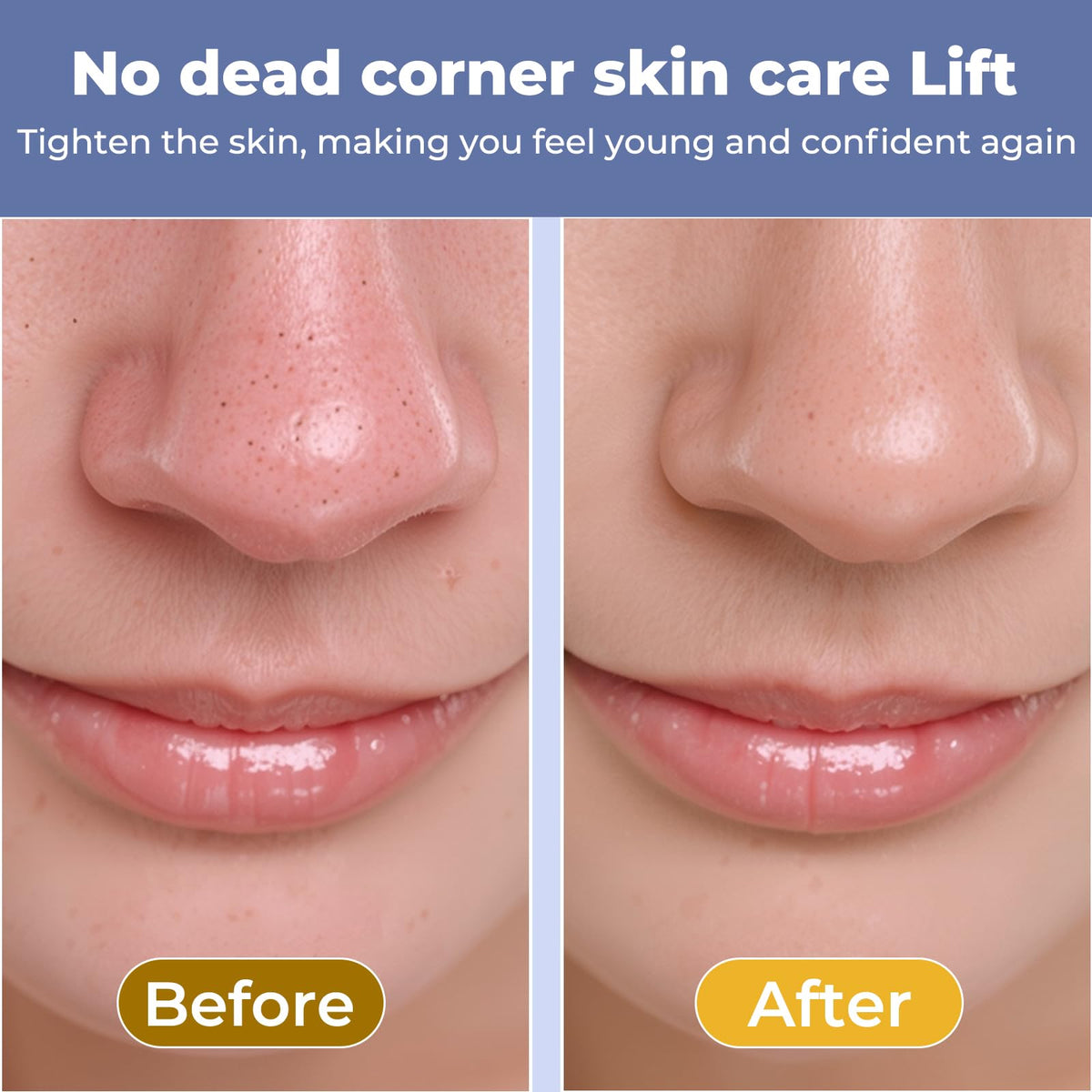MIRVIAST circular widened head close detail for larger pores benefit