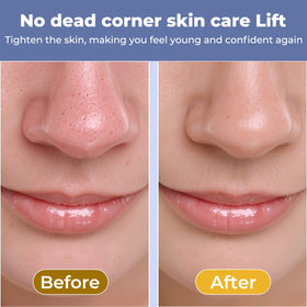 MIRVIAST circular widened head close detail for larger pores benefit