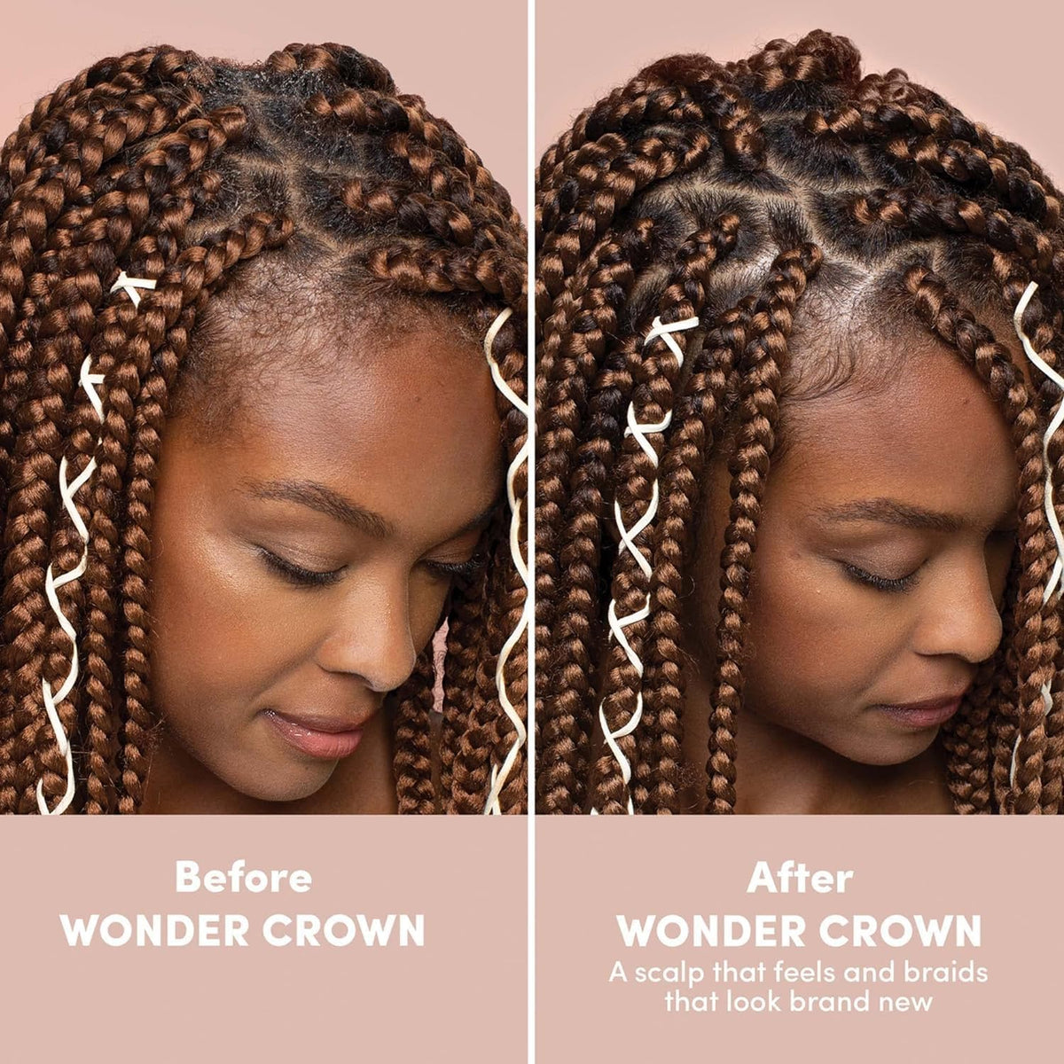 Mizani product in use applied to scalp for targeted cleansing benefit