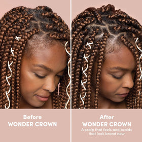 Mizani product in use applied to scalp for targeted cleansing benefit