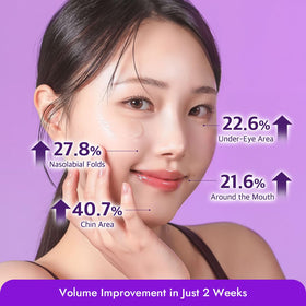 MIZON open jar showing product inside to highlight rich formula and hydrating benefit