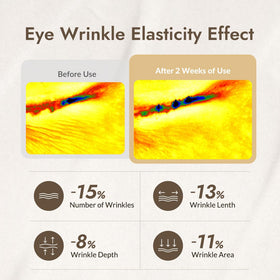MIZON applying cream under eye with ring finger, illustrates gentle targeted hydration