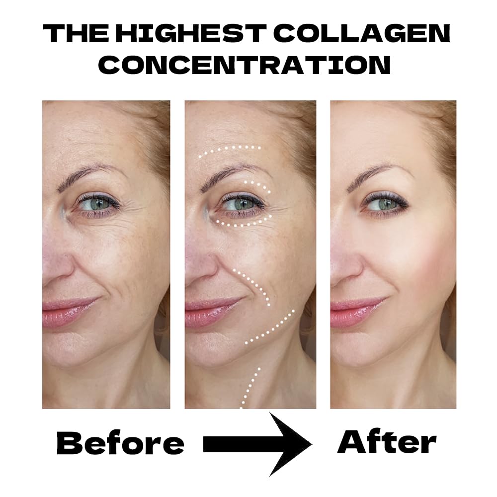 MKBLNP collagen gel texture close-up showing hydrating consistency