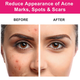 MMPANG rosehip oil texture absorbed on skin demonstrating lightweight, non-greasy finish