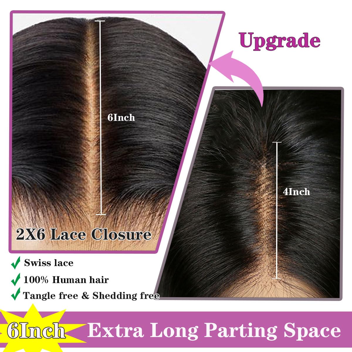 Mnador closure worn by model demonstrating realistic styling versatility