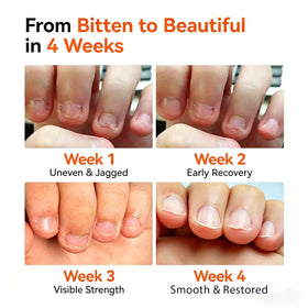 modelones invisible finish on fingertip demonstrating discreet protection
