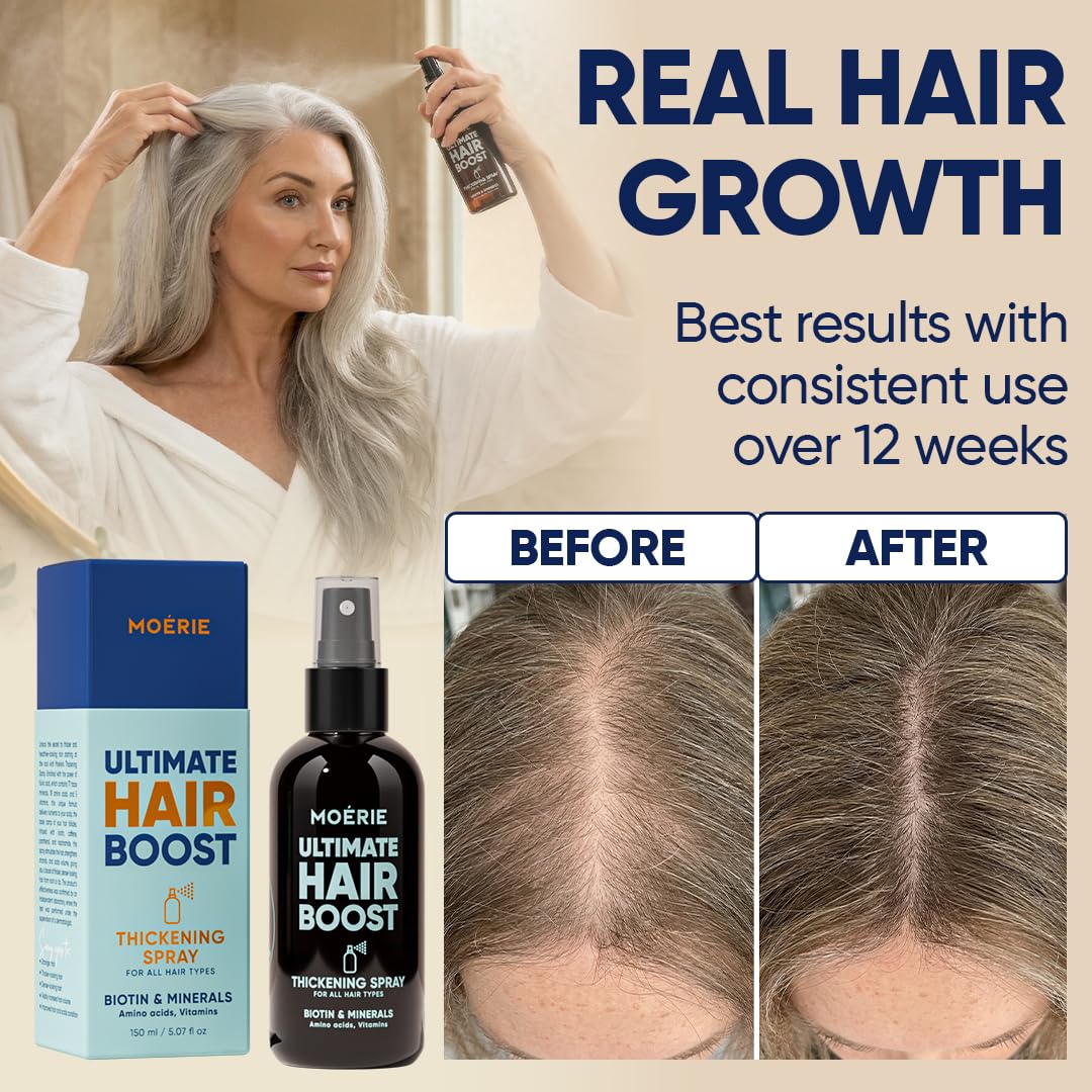 hand applying Moerie spray to a damp scalp illustrating targeted coverage and convenience