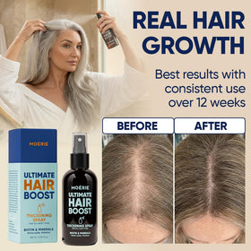 hand applying Moerie spray to a damp scalp illustrating targeted coverage and convenience