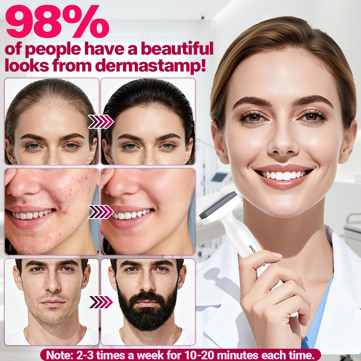MONESAO derma stamp held in hand to show scale and ergonomic grip benefit