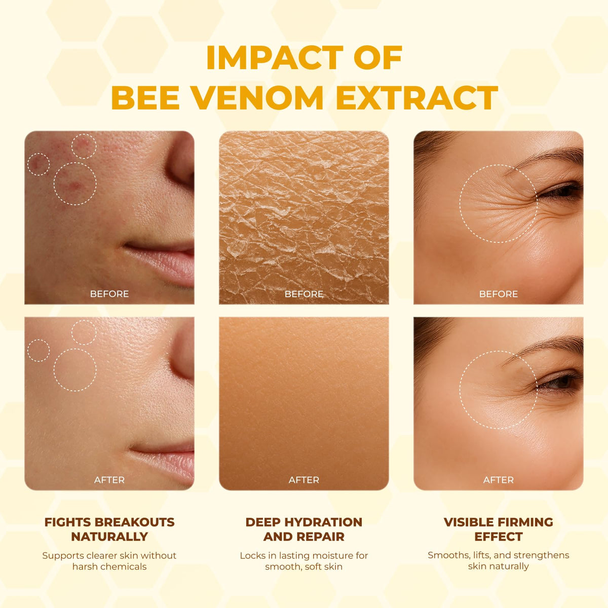 MONIER bee venom cream ingredient label showing botanical extracts and benefits