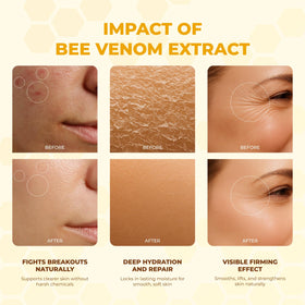 MONIER bee venom cream ingredient label showing botanical extracts and benefits