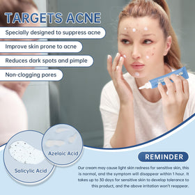 mopayzer ingredient label close-up showing azelaic acid and active benefits