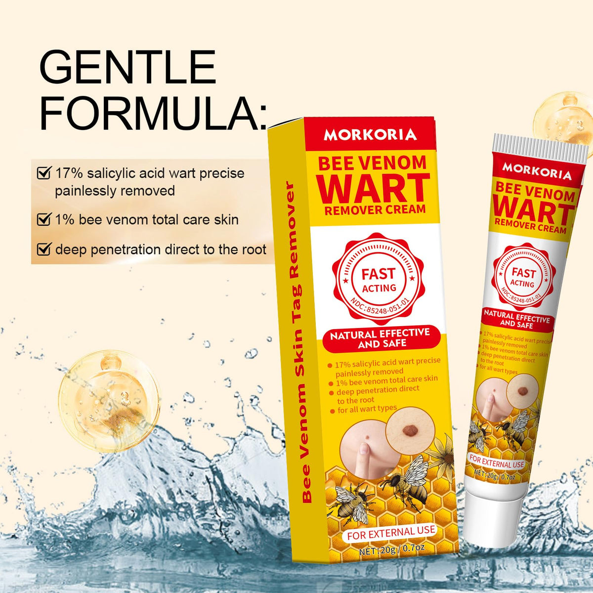 Applying MORKORIA cream to wart on hand demonstrating precise and focused treatment