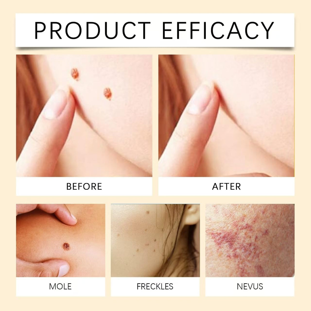 MORKORIA cream on bathroom counter suggesting easy at-home wart removal routine
