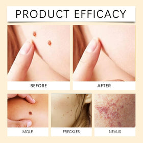 MORKORIA cream on bathroom counter suggesting easy at-home wart removal routine