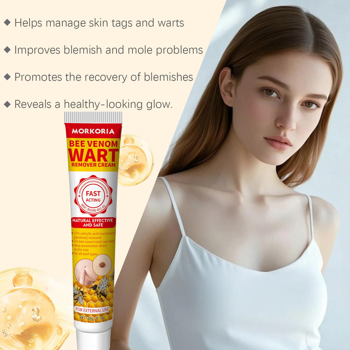 MORKORIA tube close-up label displaying active salicylic acid and bee venom ingredients