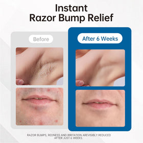 Morovan texture shot of serum drop demonstrating lightweight absorption benefit