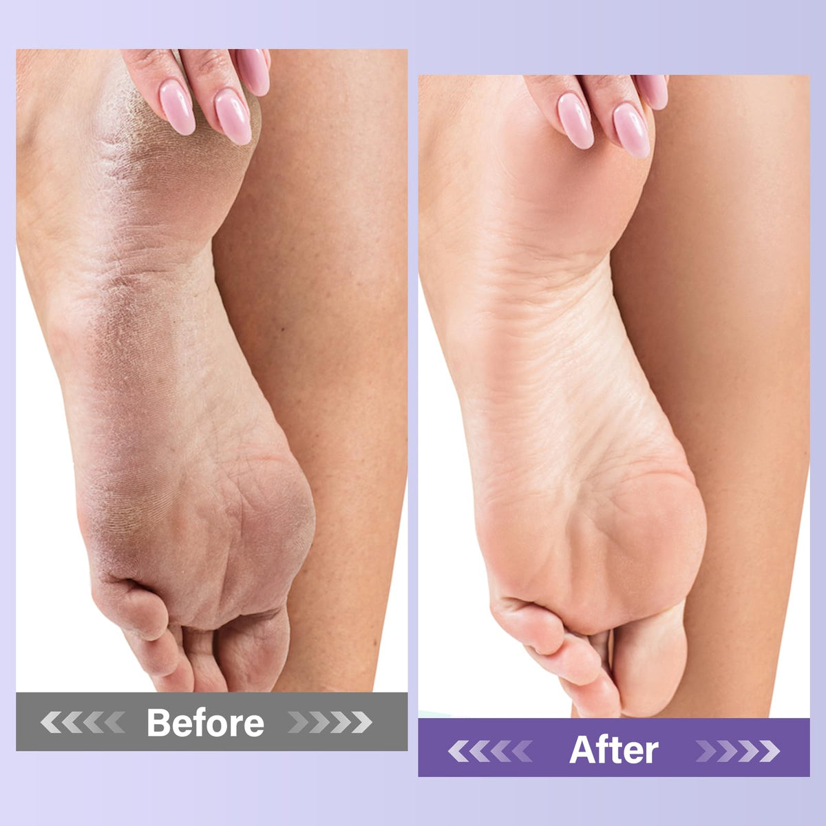MOSRROU feet soaking in bowl to show relaxation and softened skin benefit