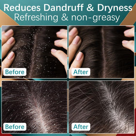 MQN beard application detail highlighting targeted facial regrowth