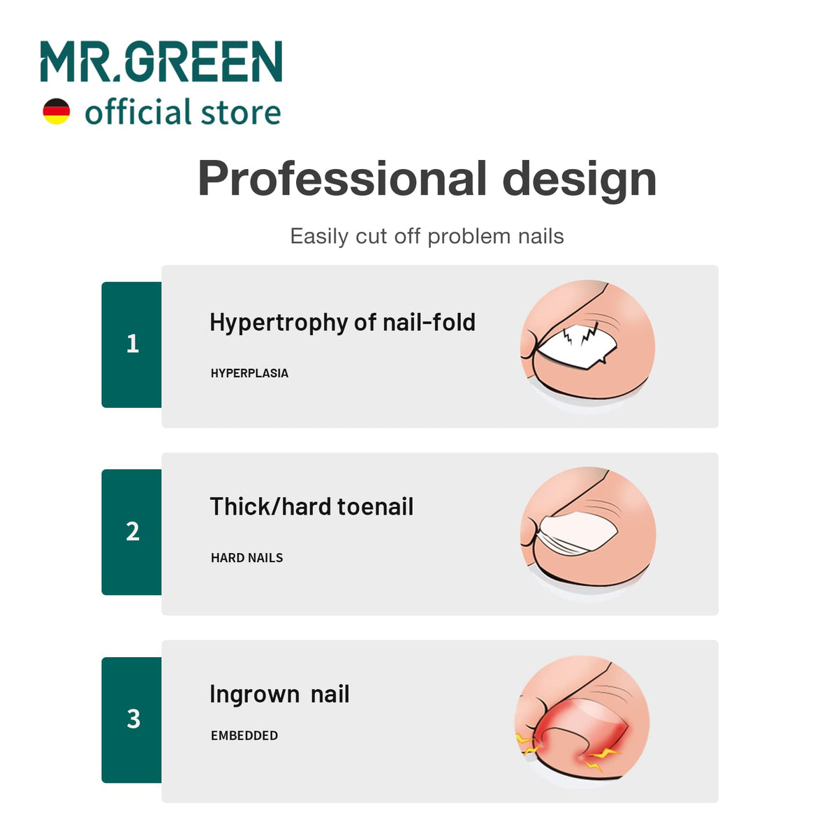 MR.GREEN handle texture detail with anti-slip plating for secure grip benefit