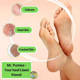 Mr. Pumice used on heel during foot soak for callus reduction