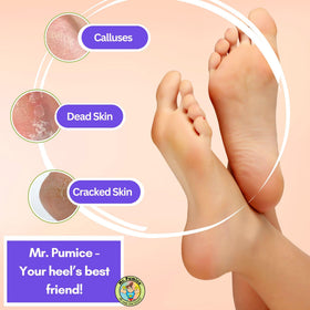 Mr. Pumice being used on heel to reduce callus thickness and restore smoothness