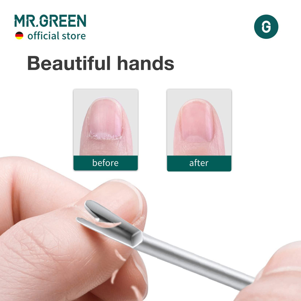 MR.GREEN handle texture with ceramic sandblast for secure, non-slip grip