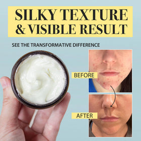 MTGBO application on hands showing fast absorption and instant softening benefit