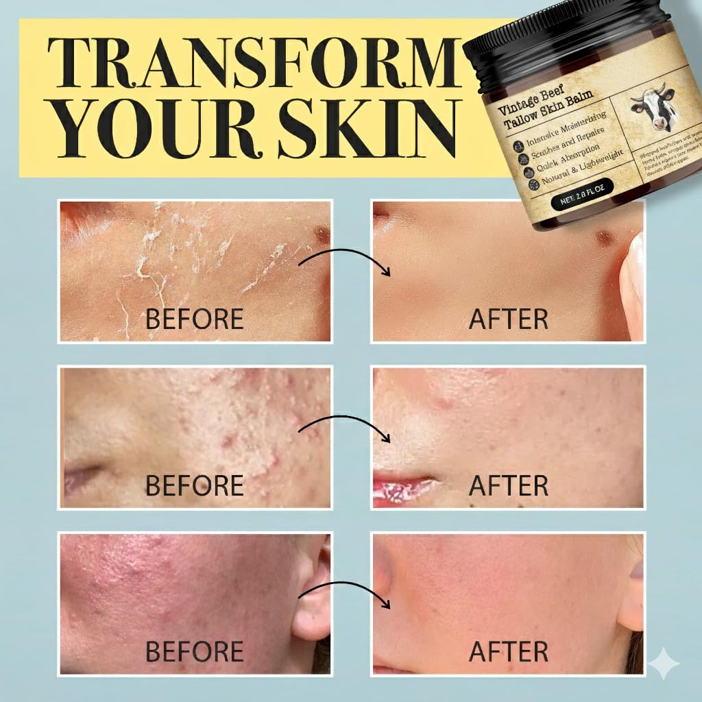 MTGBO before-and-after elbow area demonstrating reduced dryness and smoother skin