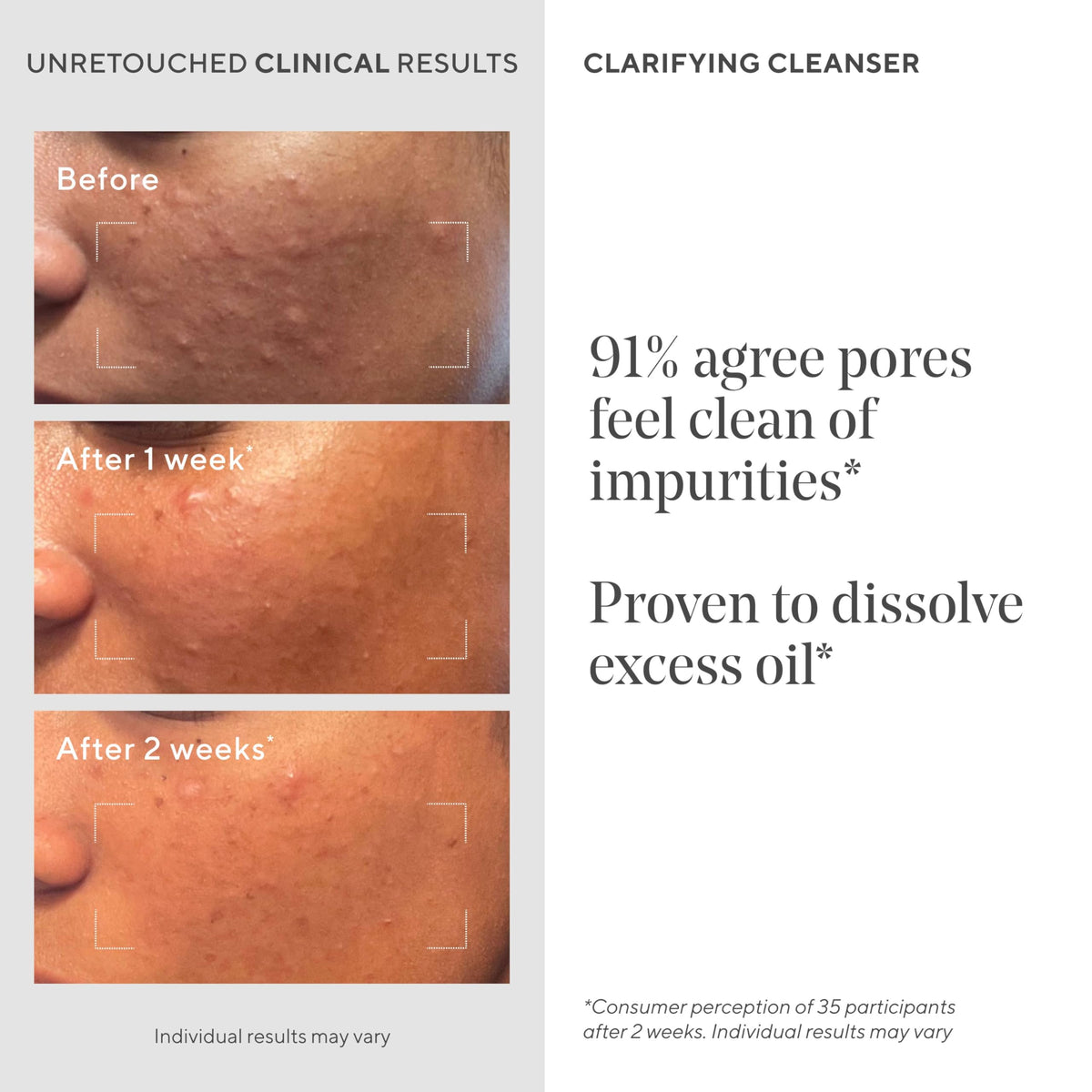 Murad cleanser being dispensed into hand for easy daily use
