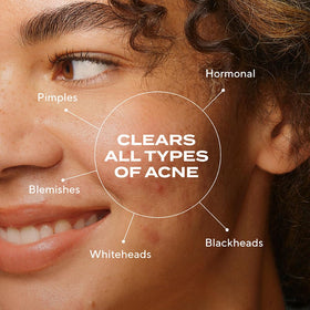 Murad close-up of serum texture highlighting quick absorption benefit