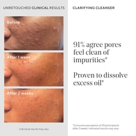 Murad green tea ingredient shot highlighting soothing antioxidant