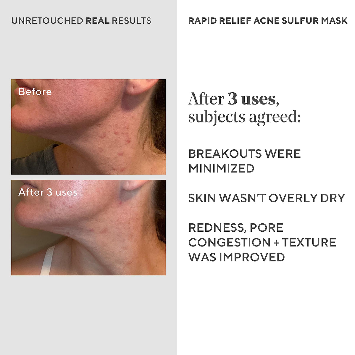 Murad rinsing mask from face showing gentle exfoliation benefit