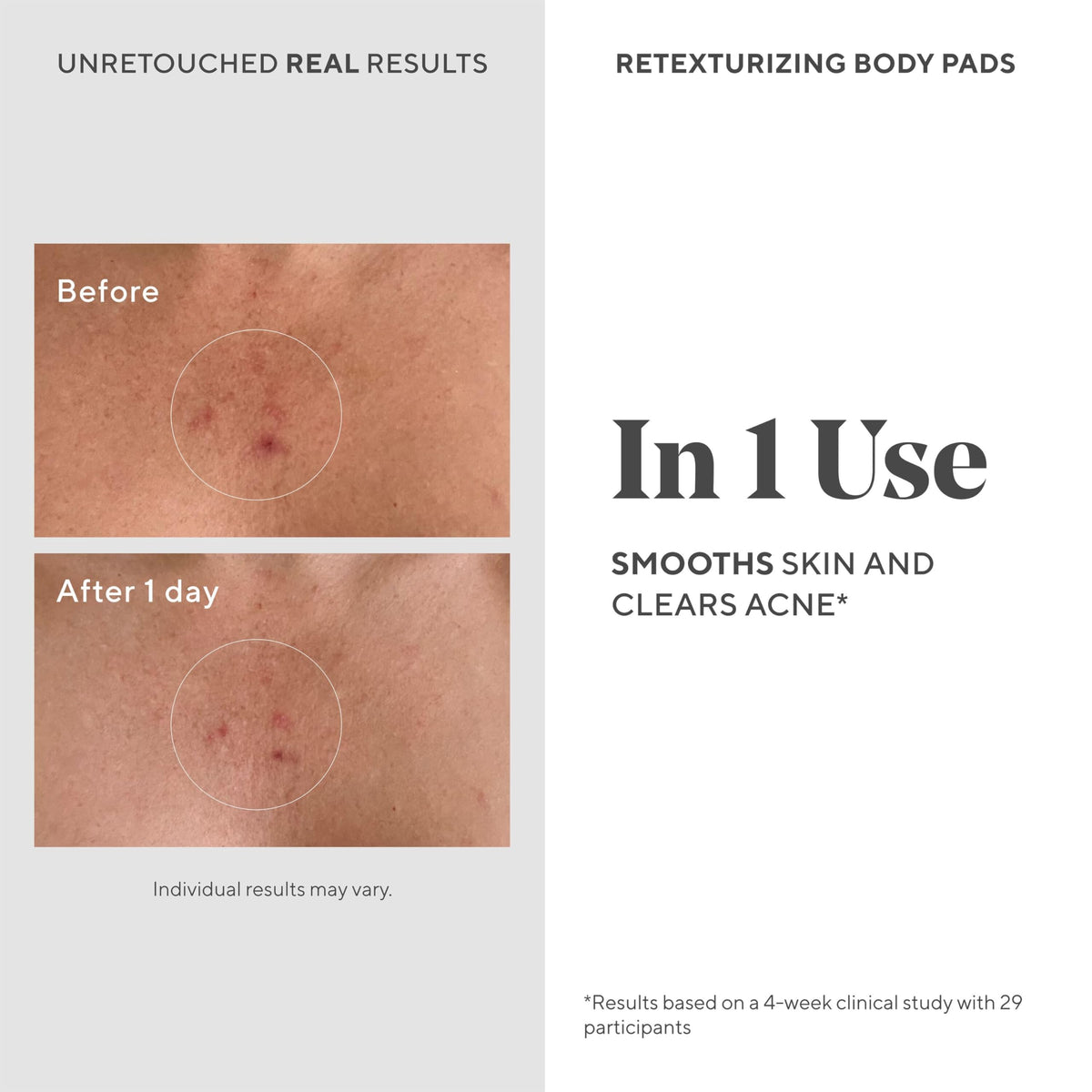 Murad pad being wiped on arm to reduce bumps and clarify skin