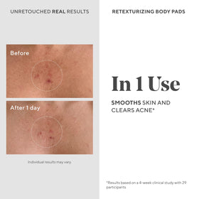 Murad pad being wiped on arm to reduce bumps and clarify skin