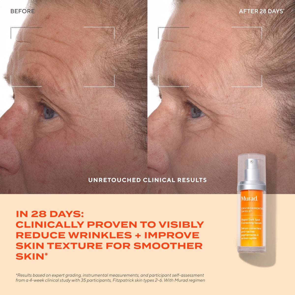 Murad label listing key ingredients like resorcinol and tranexamic acid for transparency