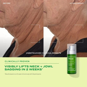 Murad serum applied to neck demonstrating lift and smoothing benefit