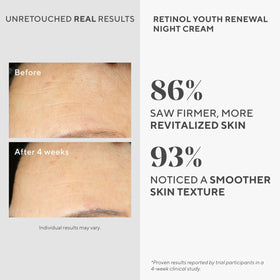Murad cream on hand being applied, demonstrating smooth spreadability and absorption