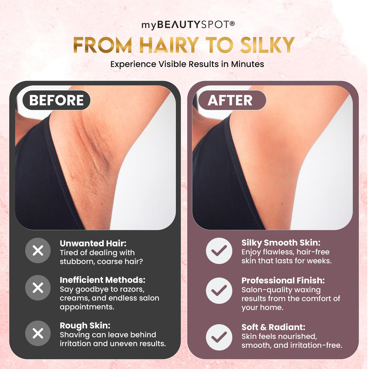 My Beauty Spot waxing in use on bikini area showing strip-free removal and reduced irritation benefit