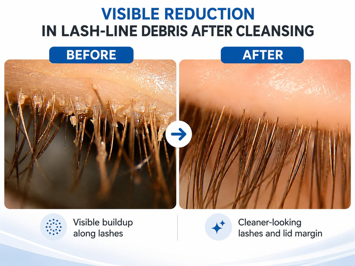 Myboclean brush close-up of fine bristles for gentle cleansing