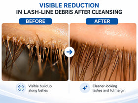 Myboclean brush close-up of fine bristles for gentle cleansing