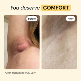 MyMagicHealer application on skin illustrating targeted protection and relief