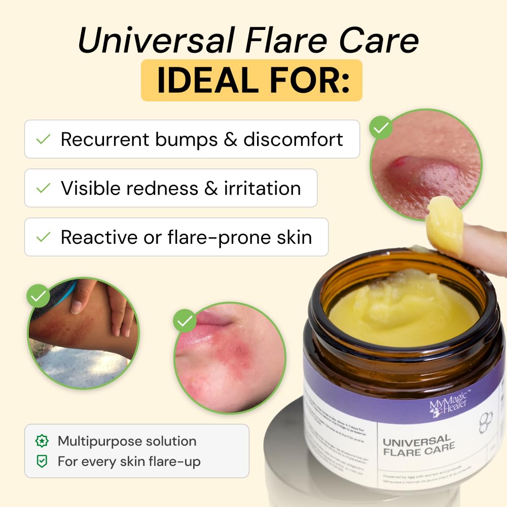 MyMagicHealer salve on fingertip ready to apply for targeted relief