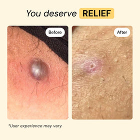 MyMagicHealer ingredient close-up highlighting natural components and calming support